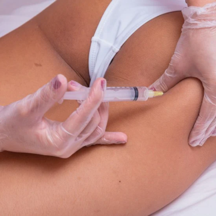 Buy 1000CC PMMA BUTTOCK INJECTIONS 1000CC PMMA BUTTOCK INJECTIONS