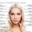 Allergan – Therapeutic / Cosmetic – Botox, 100 Units/Vial