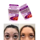Smooth Wrinkles with Botox Allergan 100iu Injection