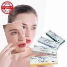 SINGFILLER DEEP HYALURONIC ACID DERMAL FILLER NOSE AUGMENTATION LIP FILLER