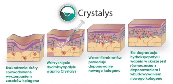 Buy Luminera Crystalys (2*1.25 ml) Luminera Crystalys (2*1.25 ml)