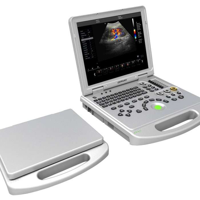 Buy Ultrasound Scanners Ultrasound Scanners